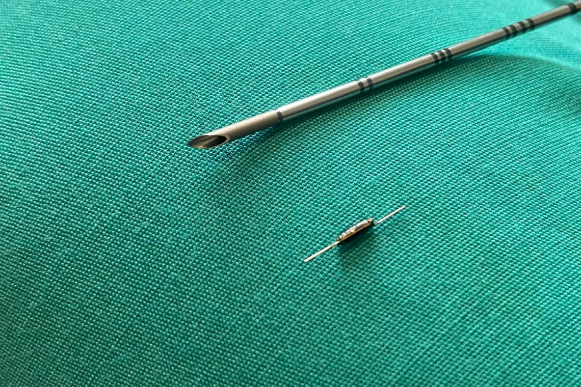 Tumori al seno: al San Camillo un innovativo dispositivo per una chirurgia oncologica di precisione